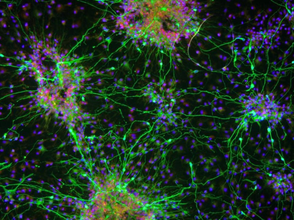 Replacing cells lost in Parkinson’s by converting their neighbours