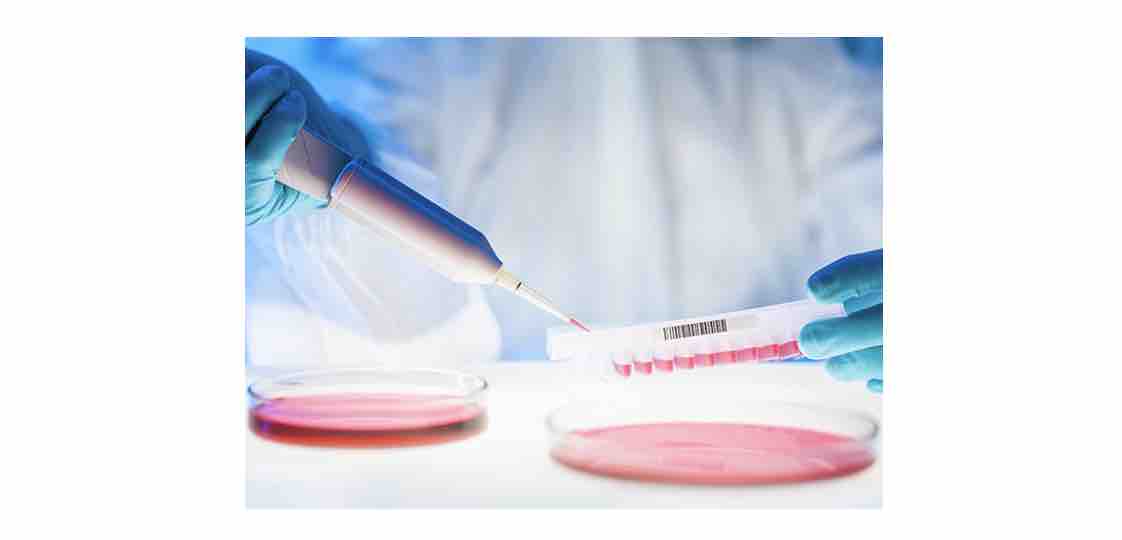 Parkinson’s UK creates Vivifi Biotech to explore further GDNF trial